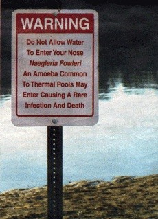 Naegleria Warning Sign